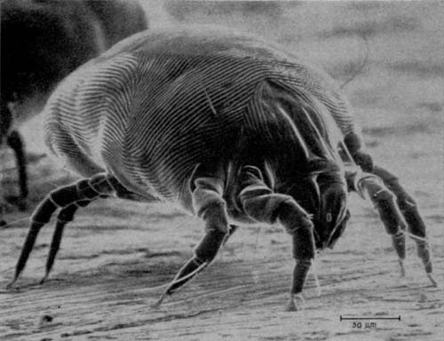 What a dustmite looks like